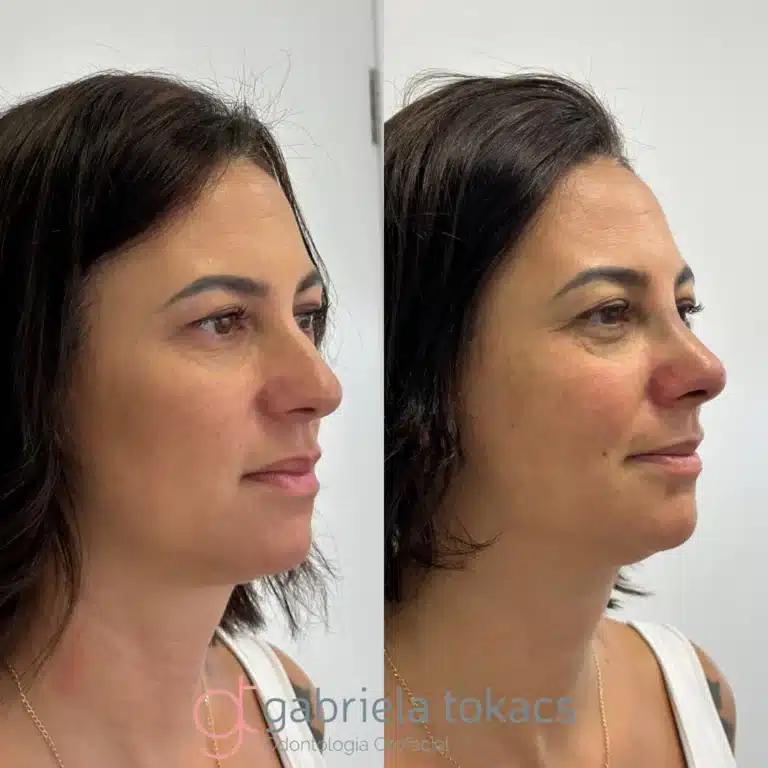 antes-depois-3