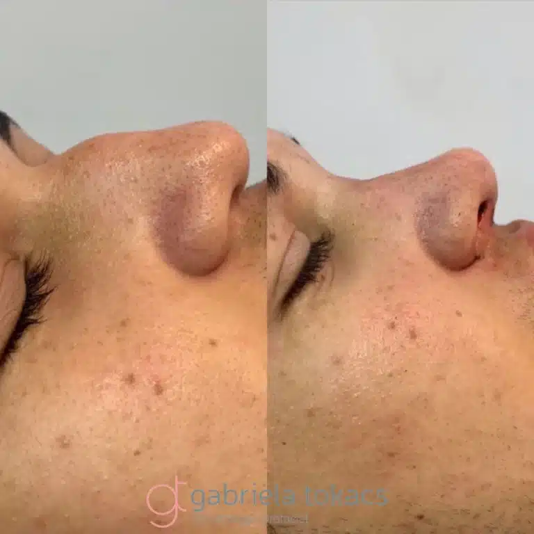 antes-depois-4