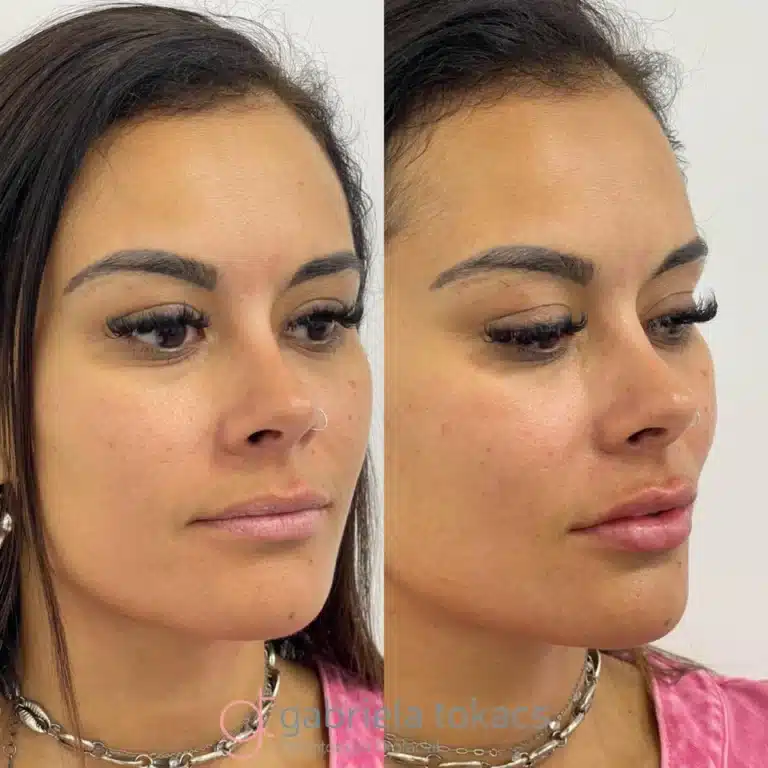 antes-depois-8