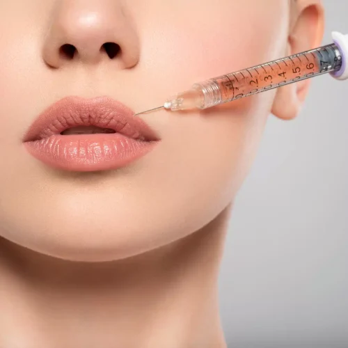 Preenchimento labial